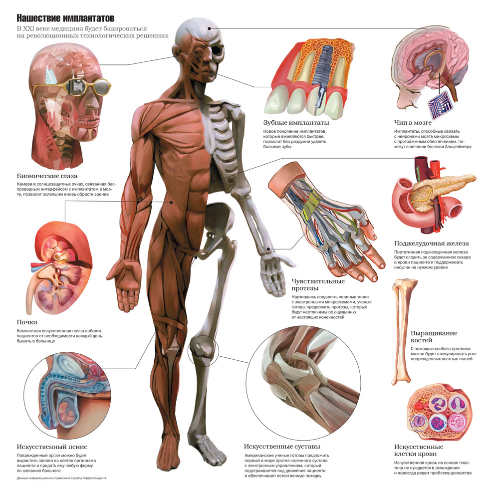 Разработки учёных в сфере развития имплантов