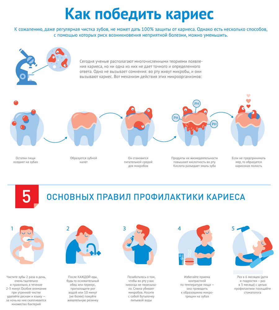 Что такое кариес и правила профилактики